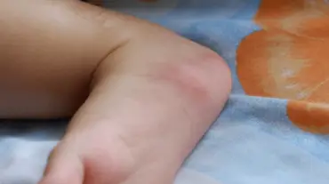 Why Pest Problems Pose Higher Risks for Children and Seniors